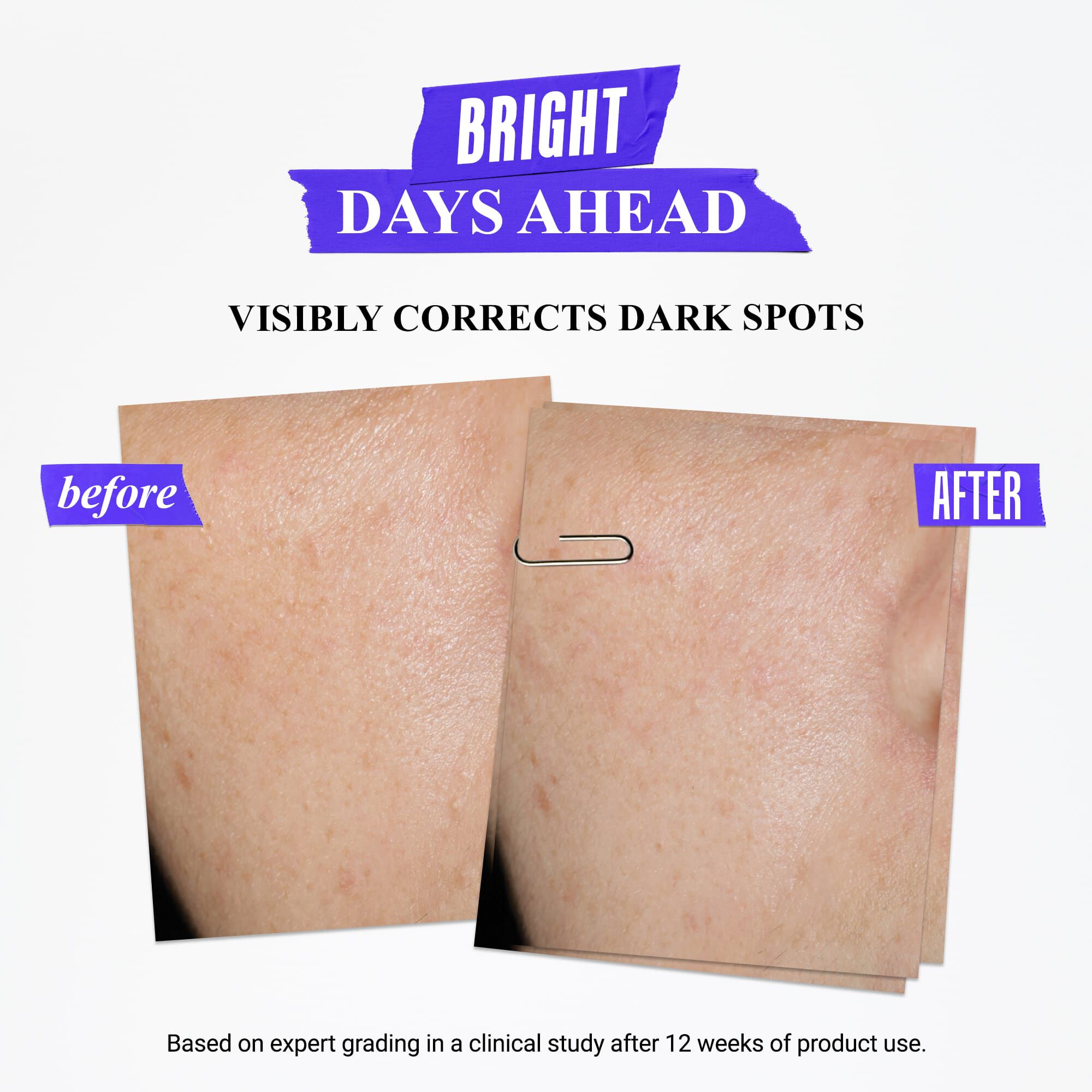 Clearly Corrective Dark Spot Correcting Serum