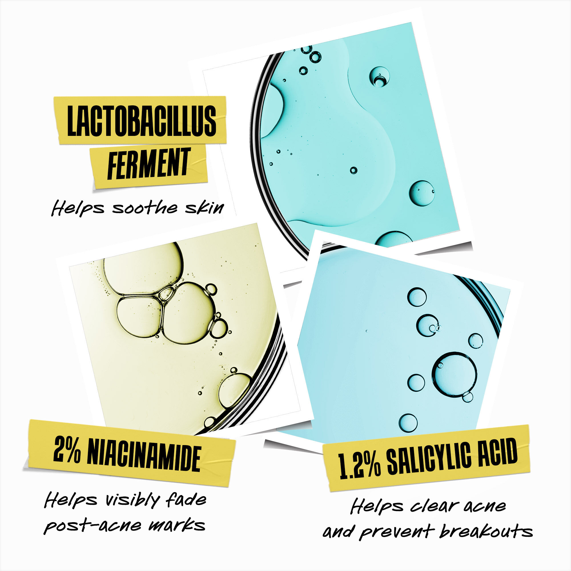 Expertly Clear Blemish-Treating & Preventing Lotion