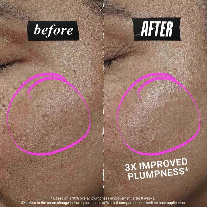 Before and after comparison of a model's cheek. The "After" photo shows "Visibly Plumper Skin" with a smoother, hydrated appearance compared to the "before" image. Focus on product results.​