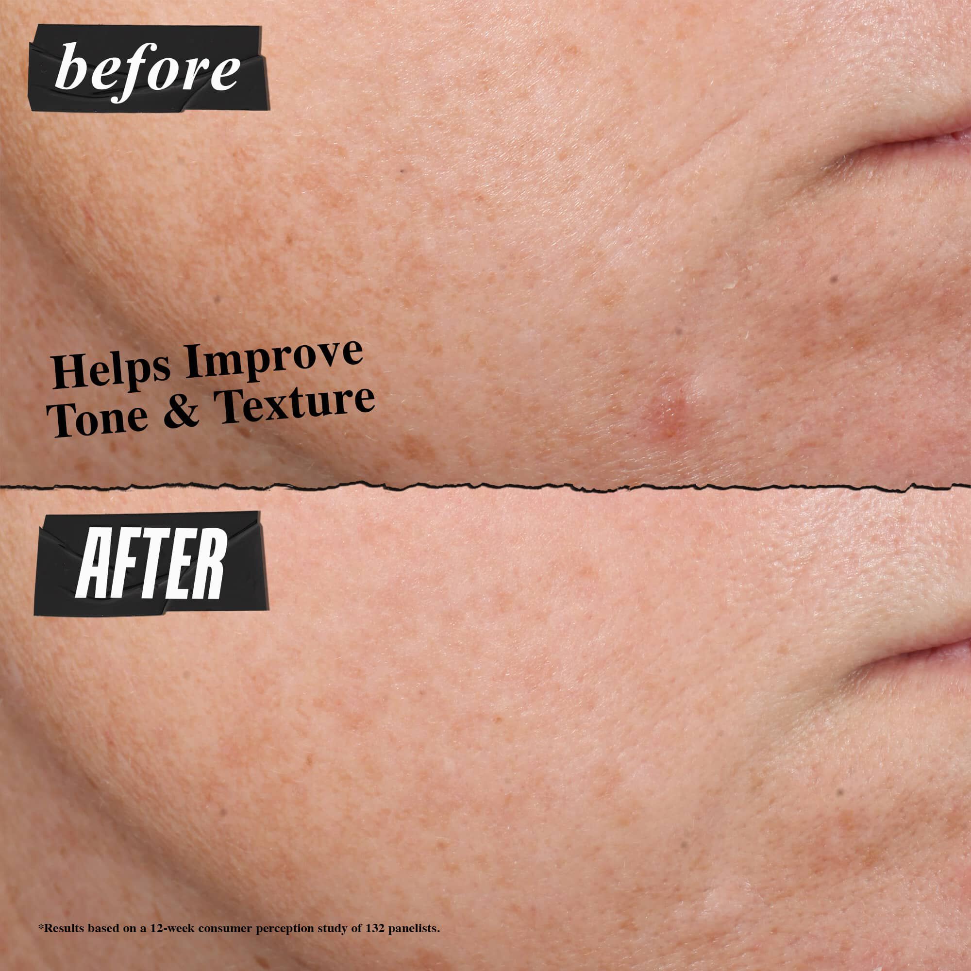 سيروم ريتينول لتجديد البشرة بجرعات صغيرة يومياً