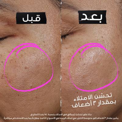 Close-up of model’s cheek with pink serum dots showing application placement, alongside an expert figure in a white coat gesturing toward the skincare tutorial.