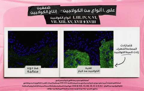 2X Collagen Production on 10 Types