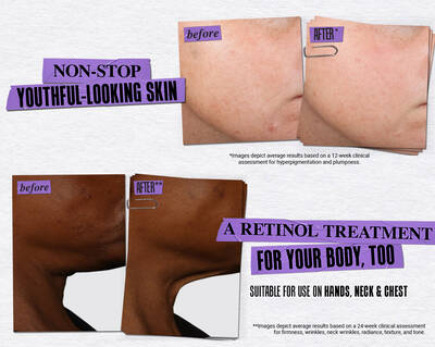 Before and After Retinol Serum