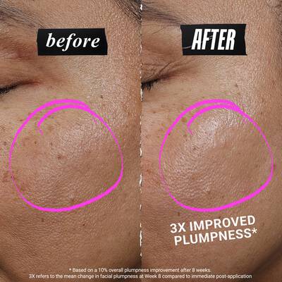 Close-up of model’s cheek with pink serum dots showing application placement, alongside an expert figure in a white coat gesturing toward the skincare tutorial.